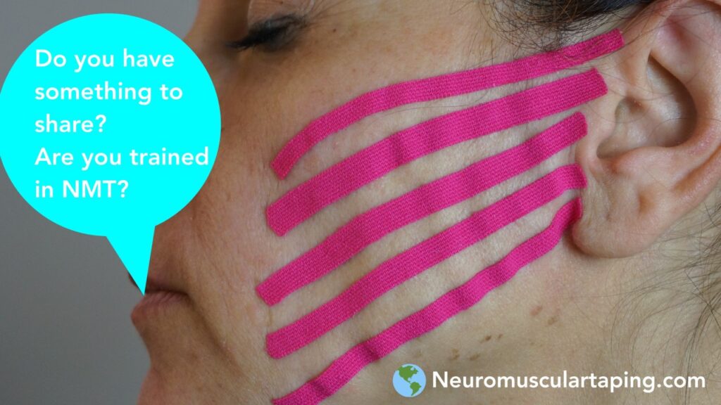NeuroMuscular Taping Decompression taping