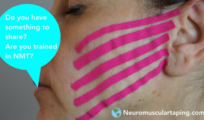 NeuroMuscular Taping Decompression taping